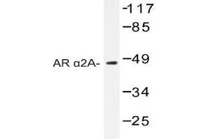 Western blot (WB) analysis of AR alpha2A antibody in extracts from Jurkat cells. (ADRA2A Antikörper)