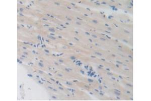 IHC-P analysis of Mouse Heart Tissue, with DAB staining. (LSR Antikörper  (AA 35-205))