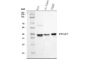 Western blot analysis of MEK3 using anti-MEK3 antibody (ABIN3043874).