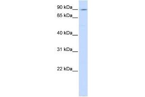 ATP2C1 antibody used at 1 ug/ml to detect target protein. (ATP2C1 Antikörper  (C-Term))