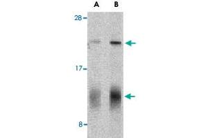 Western blot analysis of IL32 in human spleen tissue lysate with IL32 polyclonal antibody  at (A) 5 and (B) 10 ug/mL shows two isoforms of IL-32. (IL32 Antikörper  (C-Term))