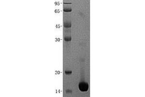 Validation with Western Blot (NHP2L1 Protein (Transcript Variant 2) (His tag))
