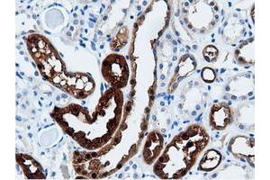 Image no. 5 for anti-Adenylate Kinase 5 (AK5) antibody (ABIN1496535) (Adenylate Kinase 5 Antikörper)