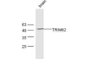 Mouse brain lysates probed with Rabbit Anti-TRIM62 Polyclonal Antibody, Unconjugated  at 1:300 overnight at 4˚C. (TRIM62 Antikörper  (AA 101-200))