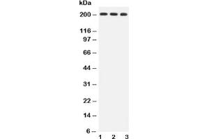 Western blot testing of BRCA1 antibody and Lane 1:  HeLa;  2: MCF-7;  3: A549 lysate (BRCA1 Antikörper  (AA 1661-1863))
