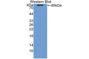 Western blot analysis of the recombinant protein. (Vitamin D-Binding Protein Antikörper  (AA 17-476))