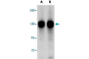 Western blot analysis of FAM120A in SK-N-SH cell lysate with FAM120A polyclonal antibody  at (A) 0. (FAM120A Antikörper  (Internal Region))