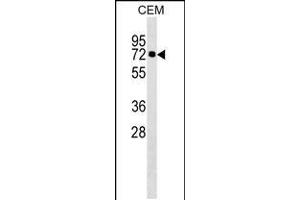 Western blot analysis in CEM cell line lysates (35ug/lane). (KLHL28 Antikörper  (C-Term))