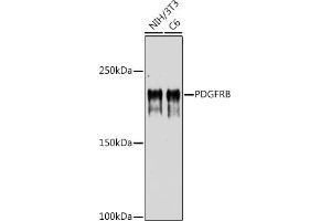 Western blot analysis of extracts of various cell lines, using PDGFRB antibody (ABIN6134579, ABIN6145372 and ABIN7101437) at 1:1000 dilution.