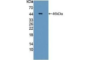Detection of Recombinant STAM2, Mouse using Polyclonal Antibody to Signal Transducing Adaptor Molecule 2 (STAM2) (STAM2 Antikörper  (AA 1-377))