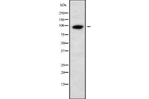 Western blot analysis UNC5A using Jurkat whole cell lysates (UNC5A Antikörper  (Internal Region))