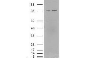 Western blot analysis of LXR in lysates of cells that were transfected with the pCMV6-ENTRY control or pCMV6-ENTRY NR1H3 cDNA using NR1H3/NR1H2 polyclonal antibody . (NR1H3 Antikörper  (AA 50-150))