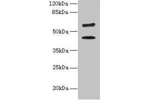 Western blot All lanes: KRT73 antibody at 4 μg/mL + HepG2 whole cell lysate Secondary Goat polyclonal to rabbit IgG at 1/10000 dilution Predicted band size: 59, 42 kDa Observed band size: 59, 42 kDa (KRT73 Antikörper  (AA 1-300))