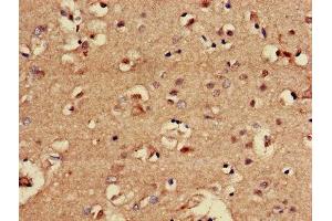 Immunohistochemistry of paraffin-embedded human brain tissue using ABIN7147705 at dilution of 1:100 (CBX5 Antikörper  (AA 1-191))