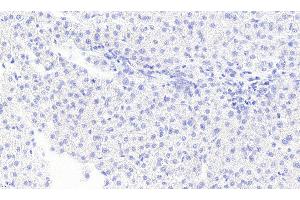 ABIN334436 Negative Control showing staining of paraffin embedded Human Liver, with no primary antibody. (MGLL Antikörper  (Internal Region))