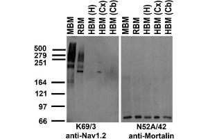 Immunoblot against crude membrane fractions from whole mouse (MBM) or rat (RBM) brain and from human hippocampus [HBM(H)], cerebral cortex [HBM(Cx)] or cerebellum [HBM(Cb)] and probed with K69/3 (left) or N52A/42 (right) TC supe.