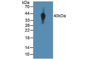 Western blot analysis of Human MCF7 Cells. (TIE1 Antikörper  (AA 701-898))