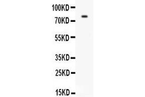 Anti-CD31 antibody, ,Western blottingAll lanes: Anti CD31  at 0. (CD31 Antikörper  (C-Term))