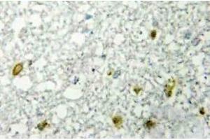 Immunohistochemistry (IHC) analyzes of FoxE1 antibody in paraffin-embedded human RAW264. (FOXE1 Antikörper)