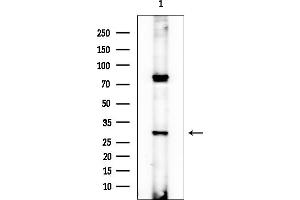 anti-Uroporphyrinogen III Synthase (UROS) antibody