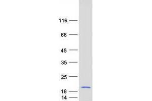 Western Blotting (WB) image for Ubiquinol-Cytochrome C Reductase Binding Protein (UQCRB) protein (Myc-DYKDDDDK Tag) (ABIN2735038)