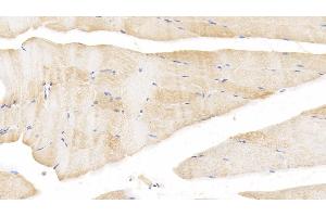 Immunohistochemistry (IHC) image for anti-Bone Morphogenetic Protein 2 (BMP2) (AA 24-395) antibody (ABIN7440320)