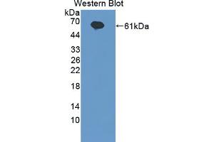 Western blot analysis of the recombinant protein. (IL20RA Antikörper  (AA 269-545))
