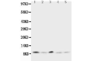 Anti-Ubiquitin antibody, Western blotting Lane 1: Rat Thymus Tissue Lysate Lane 2: Human MCF-7 Cell Lysate Lane 3: MM231 Cell Lysate Lane 4: HELA Cell Lysate Lane 5: SMMC Cell Lysate (Ubiquitin B Antikörper  (N-Term))