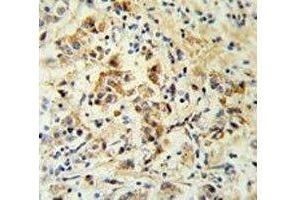 Immunohistochemistry (IHC) image for anti-BH3 Interacting Domain Death Agonist (BID) (AA 39-68) antibody (ABIN3030161)