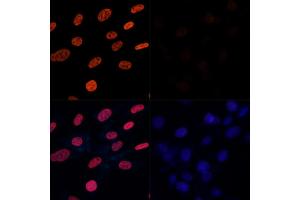 Immunofluorescence analysis of NIH-3T3 cells treated by TSA (upper left) and untreated NIH-3T3 cells(upper right) using Acetyl-Histone H3-K27 Rabbit pAb (red, ABIN7267670) at dilution of 1:100.