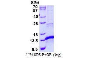 Image no. 1 for CDGSH Iron Sulfur Domain 1 (CISD1) protein (His tag) (ABIN1098400) (CISD1 Protein (His tag))