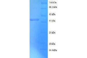 SDS-PAGE (SDS) image for Death-Associated Protein (DAP) (AA 2-102), (full length) protein (GST tag) (ABIN7479593)