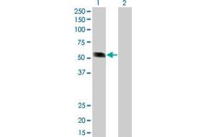 Western Blot analysis of RING1 expression in transfected 293T cell line by RING1 monoclonal antibody (M01), clone 3G6. (RING1 Antikörper  (AA 81-170))