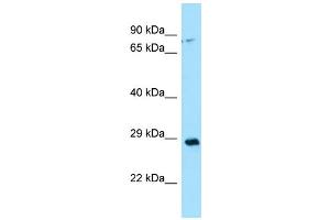 WB Suggested Anti-CA13 Antibody Titration: 1. (CA13 Antikörper  (N-Term))