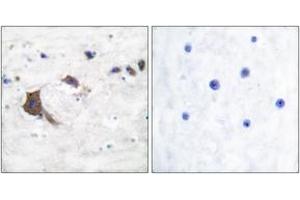 Immunohistochemistry analysis of paraffin-embedded human brain tissue, using ERAB Antibody. (HSD17B10 Antikörper  (AA 111-160))
