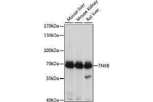 Western blot analysis of extracts of various cell lines, using TNXB antibody (ABIN3016209, ABIN3016210, ABIN3016211 and ABIN6219624) at 1:1000 dilution. (TNXB Antikörper  (AA 444-673))