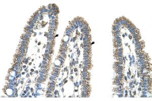 Human Intestine (CPS1 Antikörper  (Middle Region))