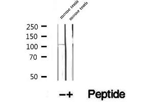 Western blot analysis of extracts of mouse testis tissue, using DIS3 antibody.