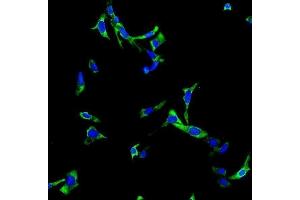 IF analysis of CHAT using anti-CHAT antibody (ABIN7600920).