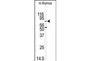 Western blot analysis of anti-EMK Antibody (C-term) (ABIN392538 and ABIN2837987) in mouse thymus tissue lysates (35 μg/lane). (MARK2 Antikörper  (C-Term))