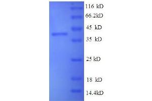 Vascular Endothelial Growth Factor C (VEGFC) (AA 112-227), (full length) protein (GST tag) (VEGFC Protein (AA 112-227, full length) (GST tag))