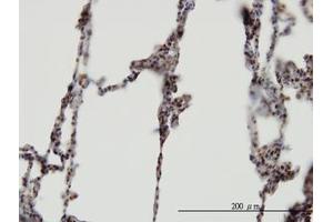 Image no. 1 for anti-XPA Binding Protein 2 (XAB2) (AA 1-856) antibody (ABIN599281) (XAB2 Antikörper  (AA 1-856))