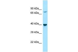 Western Blotting (WB) image for anti-Protein Phosphatase, Mg2+/Mn2+ Dependent, 1L (PPM1L) (Middle Region) antibody (ABIN2790848)