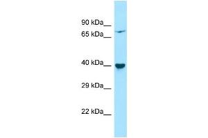 Host: Rabbit Target Name: PPM1L Sample Type: HepG2 Whole Cell lysates Antibody Dilution: 1. (PPM1L Antikörper  (Middle Region))
