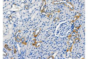 ABIN6264573 and ABIN6278624 at 1/100 staining Rat kidney tissue by IHC-P. (RAB35 Antikörper  (Internal Region))