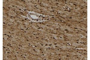 ABIN6262813 and ABIN6274021 at 1/100 staining Rat heart tissue by IHC-P.