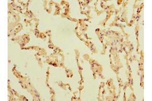 Immunohistochemistry of paraffin-embedded human lung tissue using ABIN7170179 at dilution of 1:100 (SLC23A3 Antikörper  (AA 391-492))
