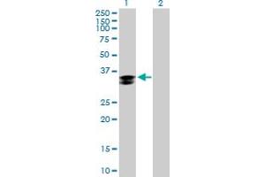 Western Blot analysis of CTSZ expression in transfected 293T cell line by CTSZ MaxPab polyclonal antibody. (Cathepsin Z Antikörper  (AA 1-303))