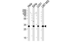 Western Blotting (WB) image for anti-Homeobox B2 (HOXB2) antibody (ABIN3004768) (HOXB2 Antikörper)