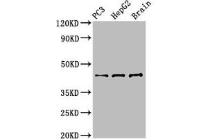 Western Blot Positive WB detected in: PC-3 whole cell lysate, HepG2 whole cell lysate, Mouse brain tissue All lanes: STAC antibody at 3 μg/mL Secondary Goat polyclonal to rabbit IgG at 1/50000 dilution Predicted band size: 45 kDa Observed band size: 45 kDa (STAC Antikörper  (AA 1-119))